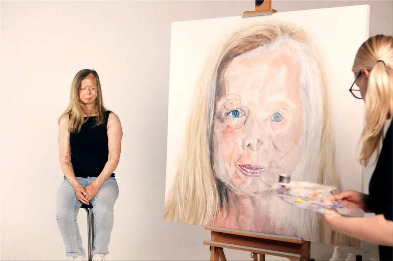 Acid Survivors Trust International (ASTi) "End Acid Violence"