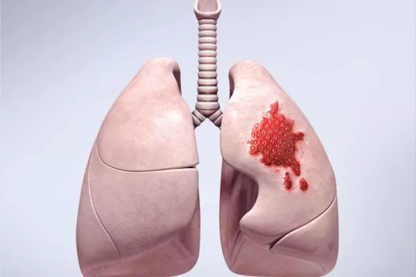 Canadian Cancer Society print ads