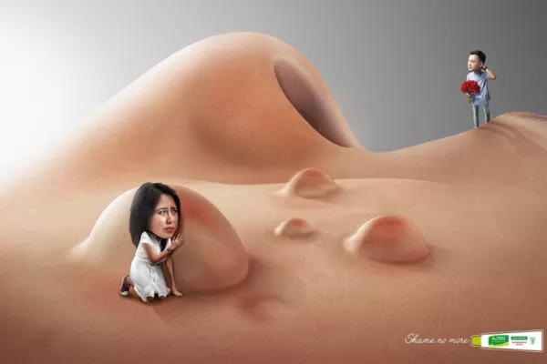 Mentholatum: Shame no more