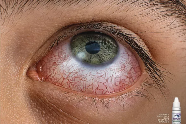 Poen "Protect your eyes from everyday damage"