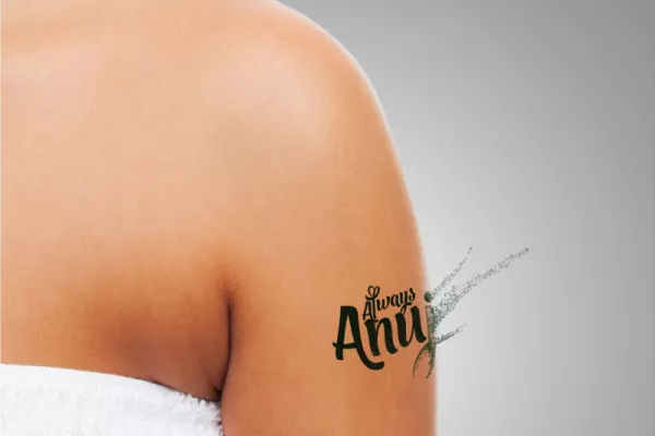 Tattoo Removal Procedure