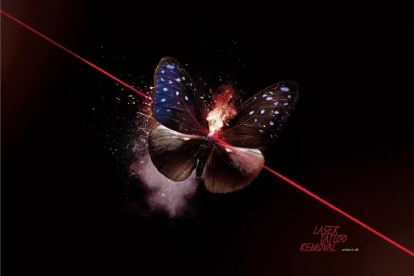 Undo-It Laser Tattoo Removal ads