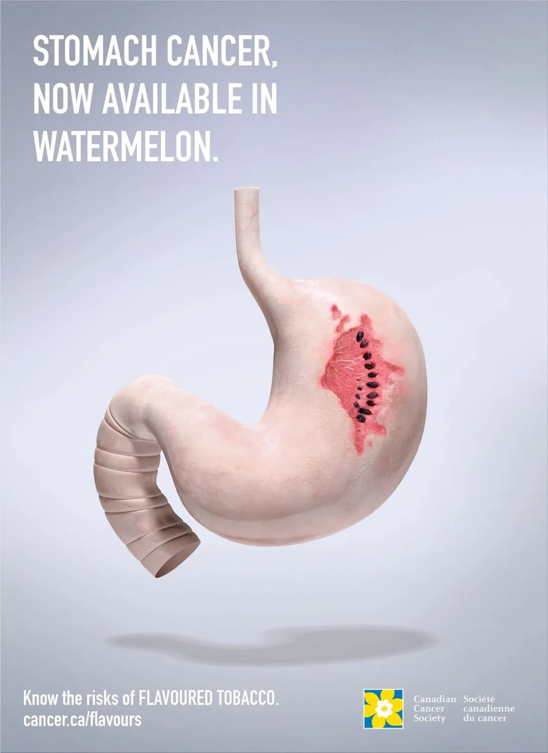 Canadian Cancer Society print ads