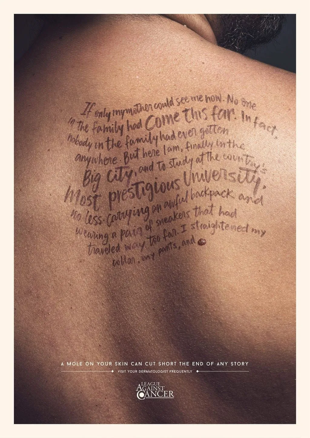 League against cancer:  A mole on your skin