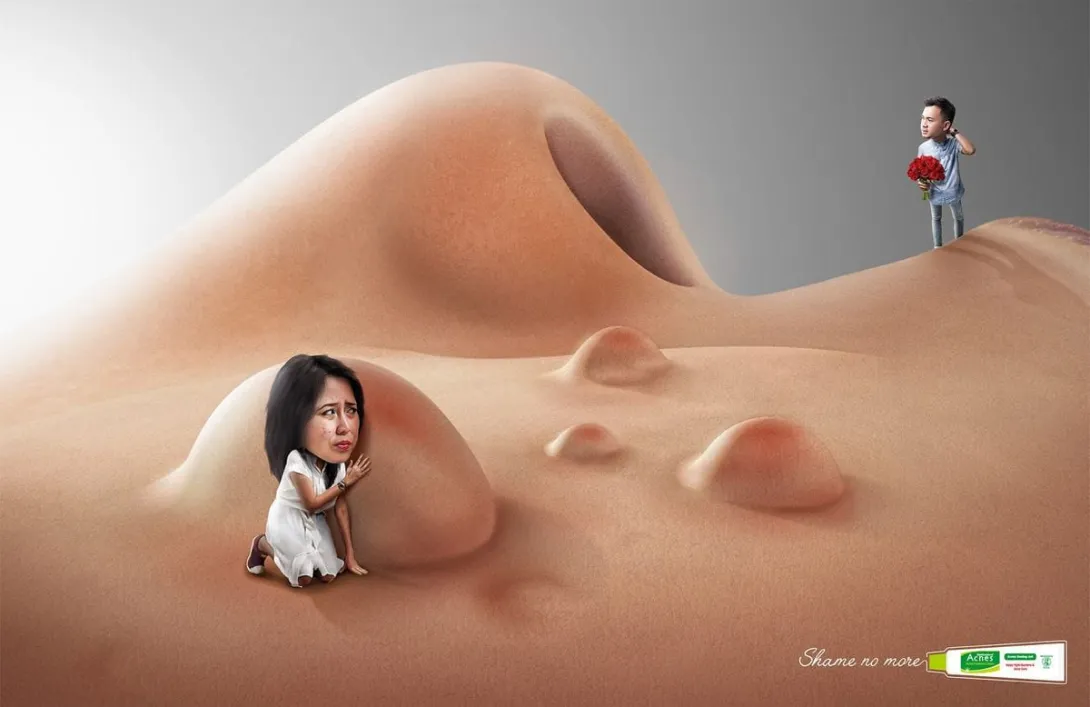 Mentholatum: Shame no more