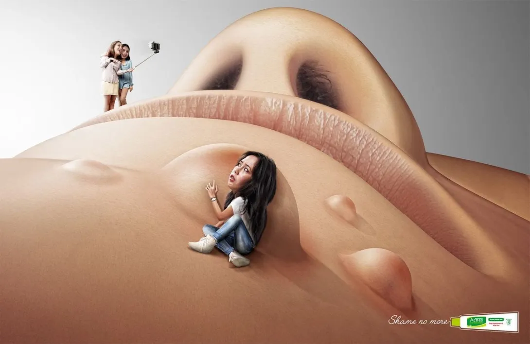 Mentholatum: Shame no more