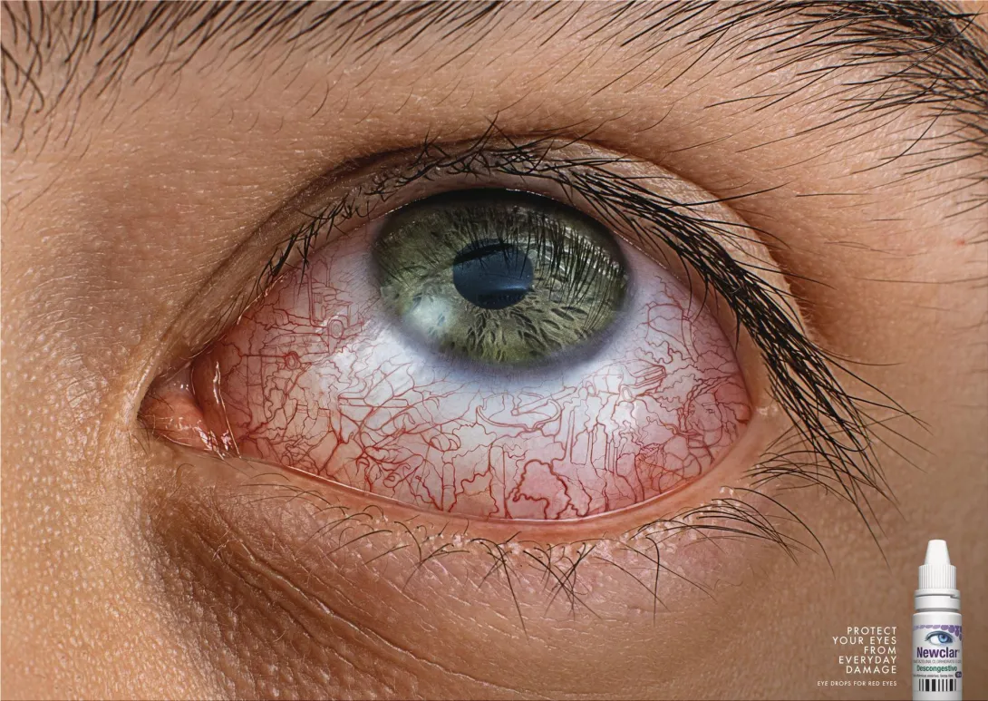 Poen "Protect your eyes from everyday damage"