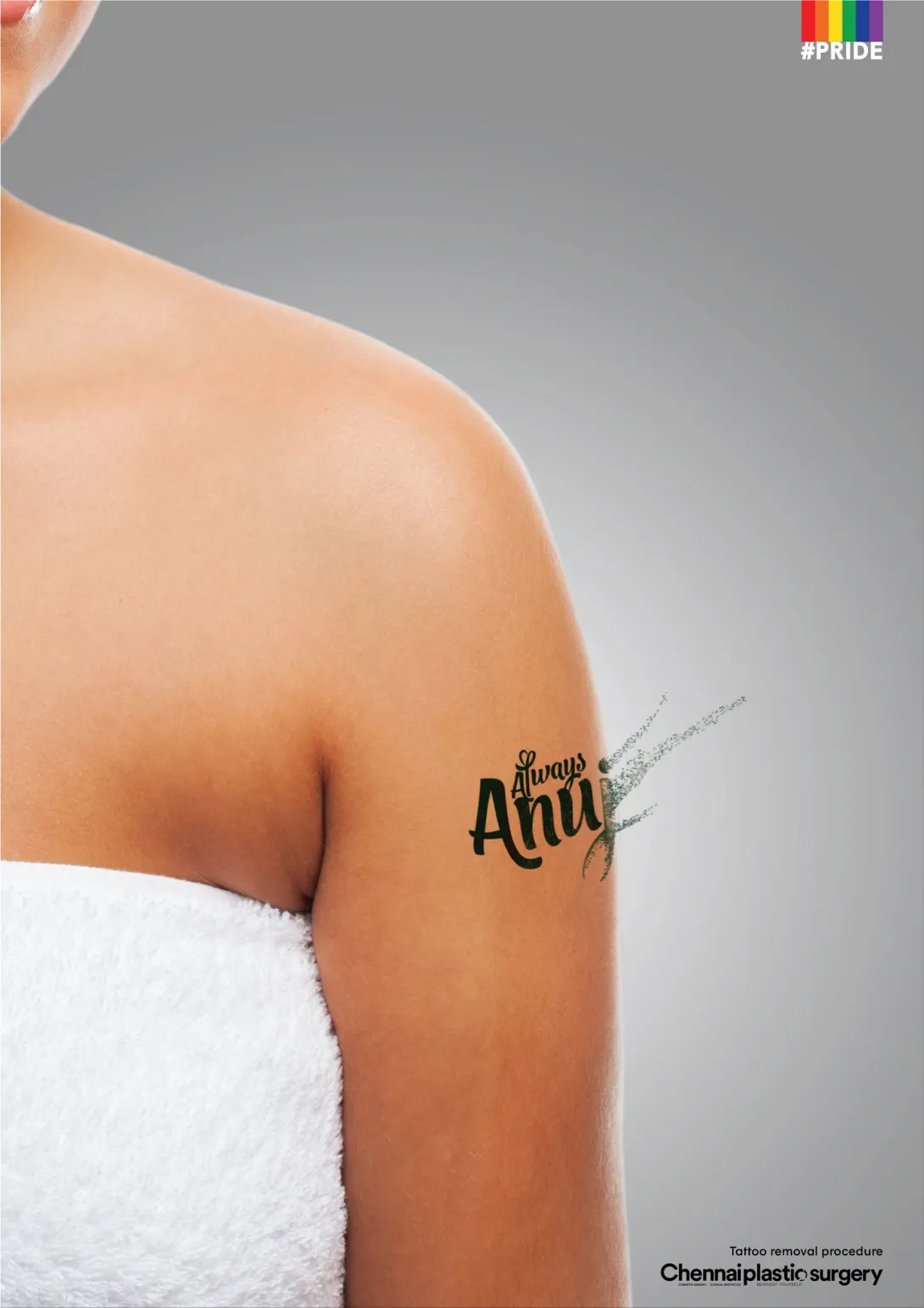 Tattoo Removal Procedure