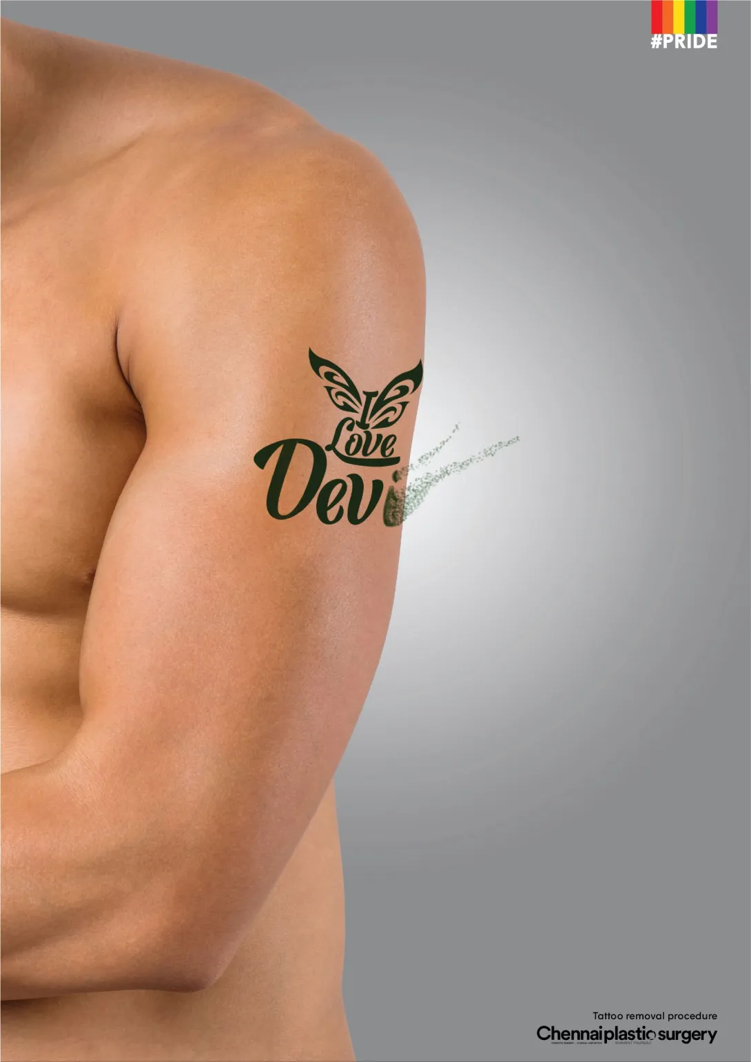 Tattoo Removal Procedure