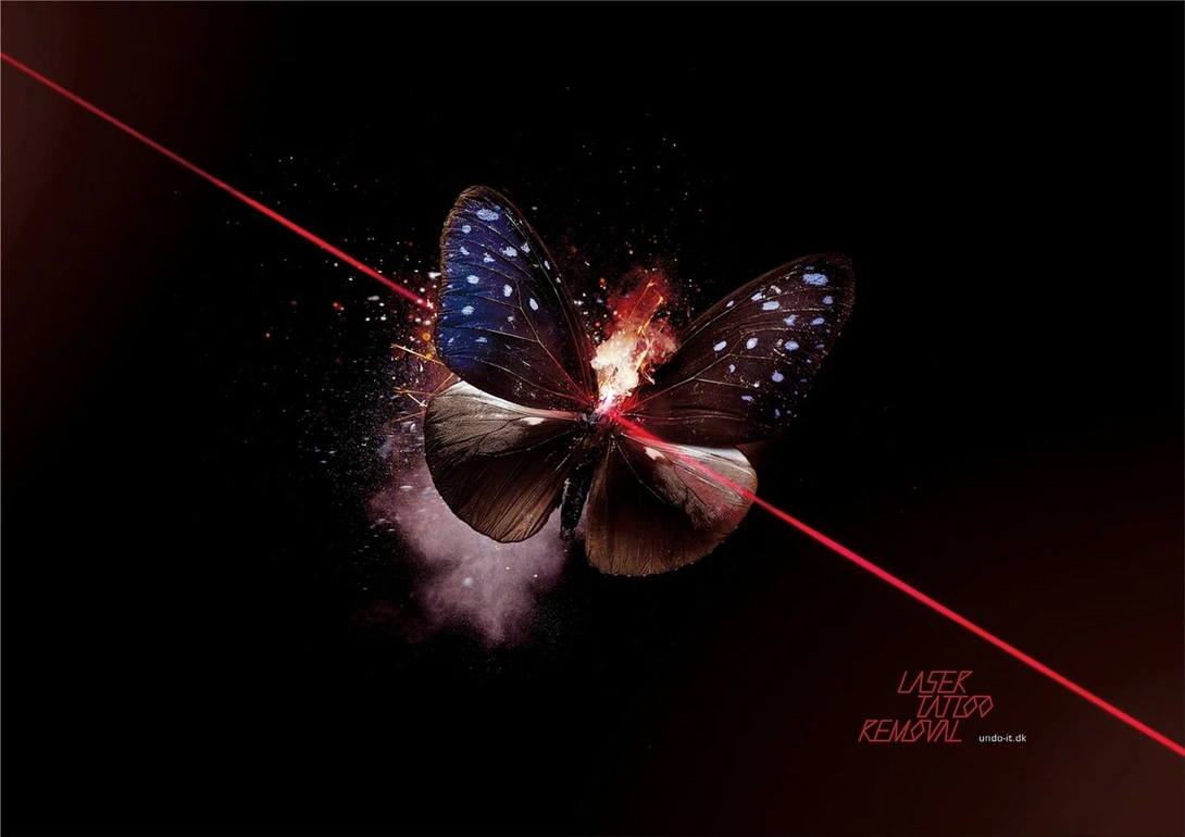 Undo-It Laser Tattoo Removal ads