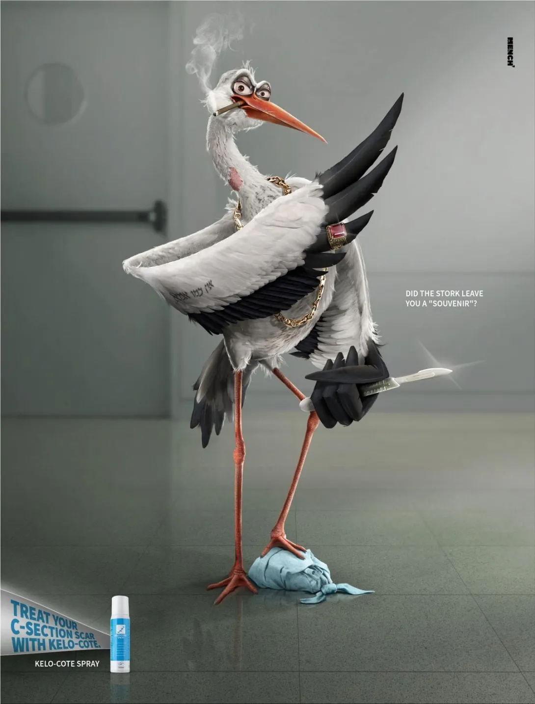 Did the stork leave you a "souvenir"?